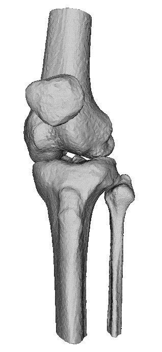 Ct knie 3D reconstructie